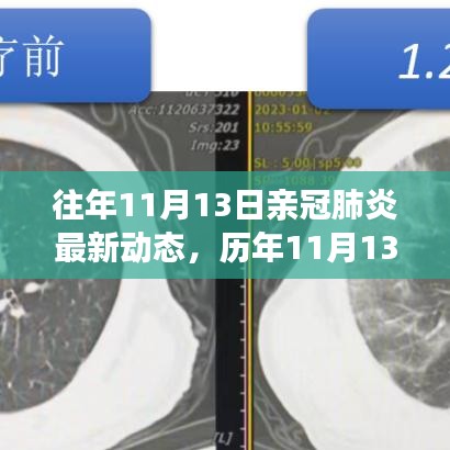 歷年11月13日新冠肺炎動態(tài)回顧，最新進(jìn)展、當(dāng)前動態(tài)與未來展望