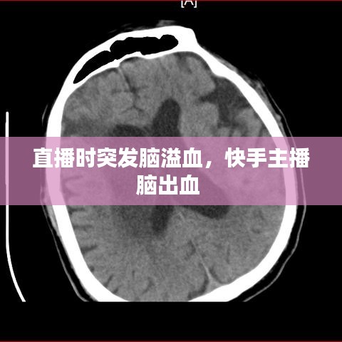 直播時(shí)突發(fā)腦溢血，快手主播腦出血 