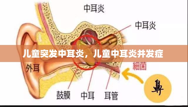 兒童突發(fā)中耳炎，兒童中耳炎并發(fā)癥 