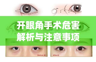 開(kāi)眼角手術(shù)危害解析與注意事項(xiàng)指南——百度健康知識(shí)分享
